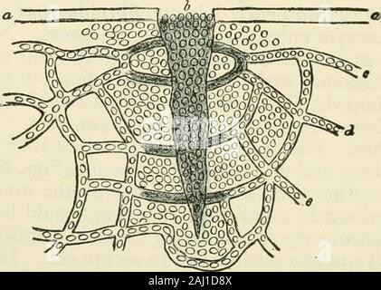 Die moderne Chirurgie, allgemeine und operativen. Abb. 6 Ich.. Abb. 62. Stockfoto