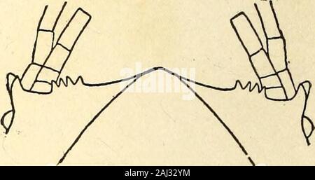 Marine Asseln in den Philippinen gesammelt von den USA Fischerei dampfer Albatross in 1907-08. Abb. 1.- gnathia Knolle - culata. Kopf andthorax. x 14 j.. Stockfoto