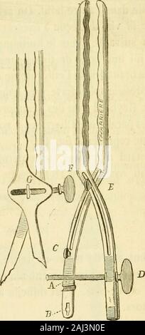 Arsenal de la Chirurgie contemporaine: Beschreibung, Mode d'Emploi et appréciation des appareils et Instrumente en Nutzung pour le Diagnostic et le traitement des maladies chirurgicales, l'orthopédie, La prothése, Les opérations simples, générales, Spéciales et obstétricales. Abb. 1300. - Entérotome de Dupuytren. Abb. 1301. - Entérotome à-Niederlassungen parallèles. la section de la valvule intestinale, en même temps que la formation dadhé - (1) Jobert, Chirurgie plastique. Paris, 1849, t. II, S. 99. (2) Dupuytren, Mémoire sur une méthode Nouvelle pour traiter les Anus acci-dentés (Mém. de lAcad.de, Stockfoto