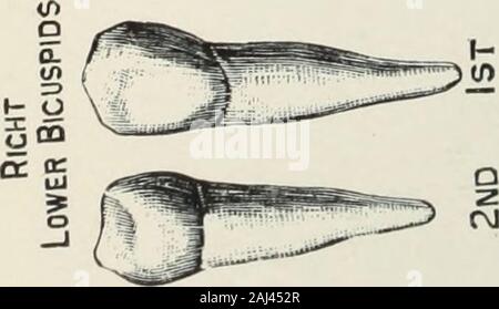 Ein Atlas der Zahnextraktionen mit Hinweisen auf die Ursachen und die Linderung von Zahnschmerzen: Für den Einsatz von Studierenden und Praktikern konzipiert. Stockfoto