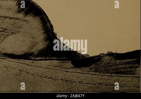 Ein Lehrbuch der zahnärztlichen Histologie und Embryologie, einschließlich Labor Richtungen. Abschnitt der Schneidezähne, zeigen zwei Zonen von Atrophie, erscheinen als zwei Nuten auf thesurface. (Ca. 8X) (Schwarz) die Abstände zwischen den Stangen sind besetzt durch Luft und therefraction streut das Licht, wodurch die weißen Aussehen. Gibt es keine Möglichkeit diese Punkte, mit Ausnahme von polishingaway das Gewebe zu entfernen, und das ist nie ratsam. Wenn die Weißen 164 DIE WIRKUNG VON KARIES AUF DEN ZAHNSCHMELZ Bereich erreicht die Oberfläche des Zahnschmelzes ist es nicht glatt andpolished, wie im normalen Zustand, sondern rauh und Kalkhaltigen. Ein oder zwei Fälle Stockfoto