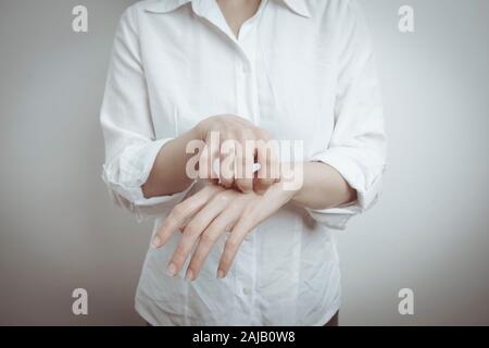 Anzeichen von Dermatitis und Schabies. Frau kratzt sich an den Händen. Hautallergie. Stockfoto