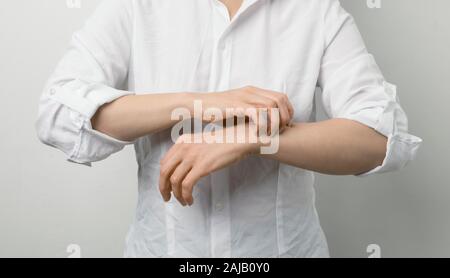 Anzeichen von Dermatitis und Schabies. Frau kratzt sich an den Händen. Hautallergie. Stockfoto