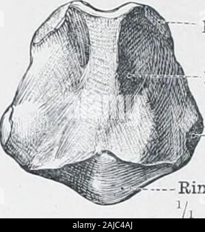 Ein Atlas der menschlichen Anatomie für Studenten und Ärzte. Platte oder lamina Lamina Schilddrüse Facette Fazies articularisthyreoidea FiCt. 763.- gesehen auf der linken Seite. Abb. 763.- c. VRTILAGO CrICOIDEA, die CRICOID KNORPEL.. Arytenoid Facette Fazies articularisarytaenoidea Platte oder lamina Lamina Schilddrüse Facette Fazies articularisthyreoidea Ring oder Bogen - Arcus - von hinten gesehen. Minderwertige tuberkel Tuberculum thyreoideurainferius Stockfoto