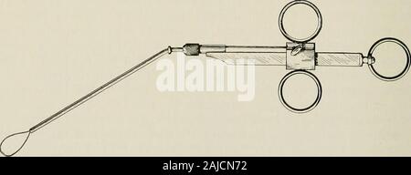 Chirurgische Behandlung; eine praktische Abhandlung über die Behandlung von chirurgischen Erkrankungen, für die Verwendung von Praktikern und Studenten der Chirurgie. Abb. 869.- Anatomie des Nasen-Rachen-Raumes und Schlund. Die stark nach hinten zurückgezogen werden sollte. Die tiefen Faszie ist dividedposteriorly und der Mantel der Halsschlagader und der Vena jugularis interna eingefahren für-Gemeinde. Mit dem scalenus anterior Muskel, wie ein Führer, eine stumpfe Dissektion ist. Abb. 870.- Schlinge entfernen Pedunculated Wucherungen von nasenrachen. Direkt nach innen, um den Raum zwischen den longus Colli und die Con-strictors des Pharynx, wo der Abszess gefunden wird. Stockfoto