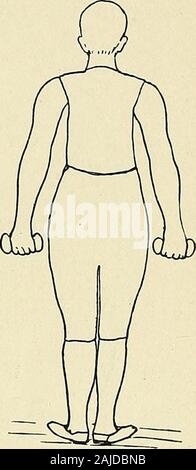 Eine Abhandlung über die orthopädische Chirurgie. Abb. 132. Abb. 133. Stockfoto