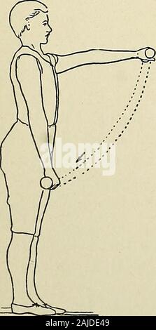 Eine Abhandlung über die orthopädische Chirurgie. Abb. 121. Abb. 122.. Stockfoto