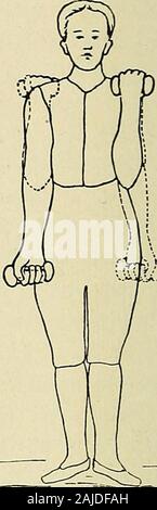 Eine Abhandlung über die orthopädische Chirurgie. Abb. 115. Abb. 116. Stockfoto