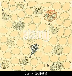 Die klinische Diagnose: Die bakteriologischen, chemischen und mikroskopischen Nachweis der Krankheit. auf die große Bedeutung der theseresearches. Durch ihre Hilfe es zum ersten Mal möglich todistinguish Malaria mit absoluter Sicherheit durch das Ergebnis einer im Falle eines Einstellungsangebots- tion des Blutes und damit haben wir eine unschätzbare Hilfe ofdiscriminating andere Neigungen, die Sie ähneln, wie obskuren Sepsis, E66 das Blut und in bestimmten Fällen der Endokarditis und Tuberkulose. 287 Erwähnen shouldnot weggelassen werden, dass der späten Jahre, combatedfrom Golgis Ansichten haben verschiedene Seiten. Dennoch, ein Stockfoto