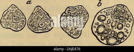 Hooper ist der Arzt Vade Mecum, oder ein Handbuch zu den Grundsätzen und der Praxis der Physik. dwith Fettkügelchen. 345. Diese Ablagerungen von Fett sindnicht auf die epithelialcells der absondernden Flächen beschränkt, sondern existiert auch in der zellulären Gewebe verbinden - ing die Gefäße des absondernden Organe. Der erste Effekt Dieser depositsof Fett in Situationen, in denen solche Einlagen nicht in einem Zustand der Gesundheit gefunden werden, ist die Größe der erkrankten Organen ohne materiell affectingtheir Funktionen zu erhöhen; aber in fortgeschrittenen Stadien der Krankheit die fattydeposits, durch die Vordringenden mehr und mehr auf die Schiffe und Stockfoto