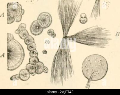 Handbuch der Pathologie: einschließlich bakteriologie, die Technik der postmortems und Methoden der pathologischen Forschung. Abb. 488. Ein. Lcucin Kugeln h, h. Tyrosin Garben.. Stockfoto