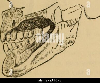 Obst und Brot, eine wissenschaftliche Diät. Abb. 7. - die Zähne des Menschen (Frugivorous). Ansicht von vorne.. Abb. 8. - die Zähne, op. Von der Seite. Ein Vergleich der Jtfan ^s Zähne iviththose anderer Tiere. - Wenn wir jetzt Com - die menschlichen Zähnen pare mit denen der 28 ZÄHNE DER VERSCHIEDENEN TIERE. Chief Vertreter der verschiedenen dieteticspecies, mit Bezug auf die peculiaritiesabove genannt -, die Größe und Art der Zähne, ihre relative Länge, Festigkeit, interveningspaces usw. - finden wir nicht nur die Großen-est Ähnlichkeit, aber zumindest mit Bezug tonumber und Art, eine komplette accordancebetween der menschlichen Zähne und die Stockfoto