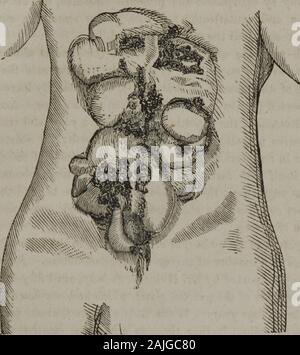 Die homöopathische Praxis der Chirurgie: Zusammen mit der operativen Chirurgie. se, vorausgesetzt, wir discoversome Regel für seine sichere und angemessene Beschäftigung. Die Objek- tion für die Verwendung dieser Artikel und der Grund, warum viele von thesecancer Putze in Verruf geraten, sich nach performedrepeated festgestellt, Kuren, ist, dass das Arsen ist manchmal ab - sorbed und produziert seine giftige Wirkung. Die gelbe Arsen (Sulfide, Orpiment) scheint zu beenmore allgemein nützlicher als die arsenious Säure haben. Es ist die principalremedy in ein oder zwei Krebs Rezepte, die sehr Erfolg gewesen. Wir haben es Stockfoto