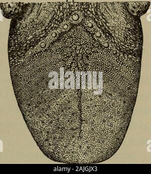 Eine elementare Physiologie und Hygiene für den Einsatz im oberen Grammatik Grade. h oder gelblich-Beschichtung, oder wenn itis helles Rot, der Arzt weiß, dass etwas iswrong. Wenn wir die Zunge sorgfältig untersuchen, finden wir, dass itappears viel wie in Abbildung 77. Es ist withnumerous wenig Trauben oder Papillen, die Papillen withtosttbuds Tonnen] f in Aussehen und varyin Verwendung abgedeckt. Einige von Ihnen, besonders die an: Diehintere der Mund, mit dem areassociated senseof Geschmack und werden calledtaste Knospen (siehe Abb. 77). Die Zunge selbst ismade vor allem ofmuscles, die schon in vielen Richtungen andenable uns Stockfoto