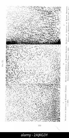 Den Ursprung und die Natur der Emotionen; verschiedene Papiere. ation, durch Überlastung, oder durch emotionale Erregung. Wir sehen nun, dass die reasonwhy wir so viel Schwierigkeit in der ZAHLREI-akute Infektionen von einander unterscheiden zu finden ist, weil Sie die gleiche kinetische Kette playupon. Unser Postulat harmonizesthe pathologischer Demokratie der kinetischen Organe, für die es ex-Ebenen nicht nur in vielen Krankheiten, die pathologicchanges in diesen Organen sind identisch, aber warum die samechanges sind als Ergebnis der emotionale Belastung und über gesehen. So können wir verstehen, wie entweder emotionale strainor akute oder c Stockfoto
