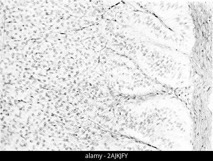 Den Ursprung und die Natur der Emotionen; verschiedene Papiere. Er Nebennieren, während die adrenalwhose Verbindung mit dem Gehirn durch thedivision seiner Nervenversorgung gebrochen wurde, wird noch genügend ad produzieren - minncare Leben zu unterstützen. Von der starken Affinität des Gehirns - Zellen für adrenalinwhich in unseren Experimenten erschienen ist, können wir die stronglysuspect Nissl Substanz ist eine flüchtige, extremelyunstable Kombination bestimmter Teile des Gehirns - cellsand Adrenalin, weil die Nebennieren allein nicht theNissl nehmen Fleck und das Gehirn beraubt Adrenalin auch nicht nehmen Nissl Fleck. Die Stockfoto