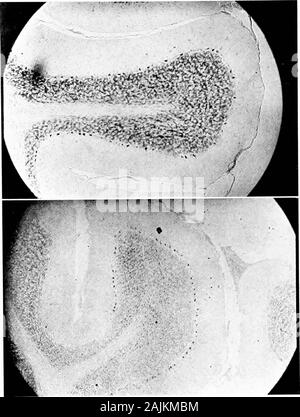 Den Ursprung und die Natur der Emotionen; verschiedene Papiere. rves Leben, wenn es von acuteinfections bedroht. Der Beitrag des Gehirns - Zellen zur Produktion von Wärme wird entweder das Ergebnis der direkten conversionof Ihre gespeicherte Energie in Wärme oder der Umwandlung Ihres latente Energie in Strom oder eine ähnliche Kraft, whichin wiederum bestimmte Drüsen und nuiscles latentenergy in Wärme umwandelt. Eine weitere Unterstützung für das Postulat, dass das Gehirn - cellscontribute auf die Produktion von Fieber durch Senden Impulse Muskeln andie ist in der Wirkung der muskulären Anstrengung, oder ofothe gefunden Stockfoto