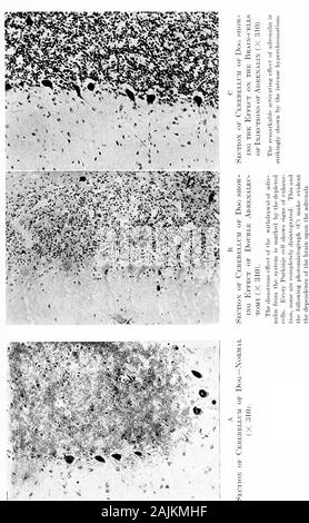 Den Ursprung und die Natur der Emotionen; verschiedene Papiere. 2. Wenn beide Nebennieren sind ausgeschnitten und keine otherfactor eingeführt wird, die nissl Substanz dis schrittweise - wird vom Gehirn-Zellen bis zum Tod. Diese reachingpoint wird. l) e bis später berücksichtigt (Wig. Gehen). Hier unsere purjiose ist die Ursache für das Gehirn - cellchanges zu diskutieren. Wir haben gesehen, dass in gekreuzten Gehirn und bodycirculation Trauma verursacht Veränderungen in den Zellen der brainwhich vom traumatisierten Körper getrennt ist durch itscirculation, aber was ist mit dem traumatizedbf verbunden) dy durch das Nervensystem. Wir haben gesehen, dass Stockfoto
