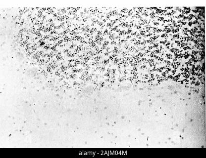 Den Ursprung und die Natur der Emotionen; verschiedene Papiere. Abb. 39 B. - Abschnitt von HumanCerebellum, Anzeigen Ef-fekte von Alkohol (nach Deathfrom Delirium Tremens). (Camera lucida Zeichnungen.) 118 DIE EMOTIONEN? o. 2 2 =^ £ 0,3 X; Stockfoto