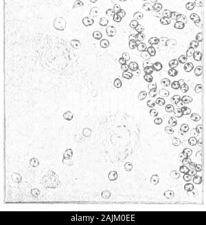 Den Ursprung und die Natur der Emotionen; verschiedene Papiere. Abb. 39 B. - Abschnitt von HumanCerebellum, Anzeigen Ef-fekte von Alkohol (nach Deathfrom Delirium Tremens). (Camera lucida Zeichnungen.) 118 DIE EMOTIONEN? o Stockfoto