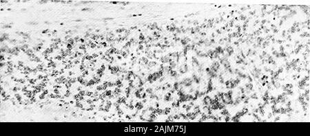 Den Ursprung und die Natur der Emotionen; verschiedene Papiere. Verein. Die fast weltweite Angst vor Schlangen, von Blut und von Deathand Leichen wie eine phylogenetische Ursprung haben kann. Reviously Itwas]) teilte mit, dass im Rahmen der Reiz der Angst animalsshow übernatürlichen Kraft. Eine Analyse der phenomenaof Angst zeigt, dass, soweit dies festgestellt werden kann, werden alle thefunctions des Körpers Ref (uiring die Ausgaben für Energie, und die keine direkte Unterstützung in der efiV) Es towardself - Erhaltung, ausgesetzt sind. In den freiwilligen Ausgaben - ture von nuiscular Energie, in der Verfolgung, die Aussetzung der Stockfoto