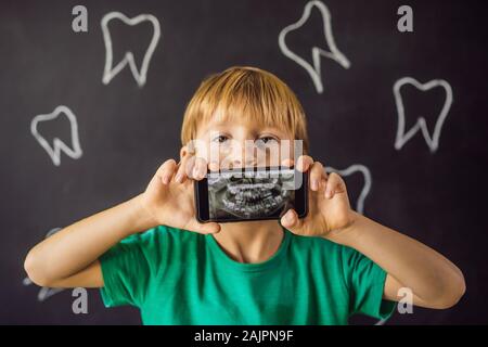 Der junge zeigt seine X-ray Image seiner Zähne mit außergewöhnlich seltsame extra Zahn. Kinder- Zahnheilkunde. Patienten Kieferorthopäde Stockfoto