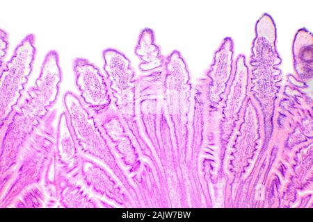 Сross-Abschnitt des Dünndarms unter dem Mikroskop (Dünndarm Sec.) Stockfoto