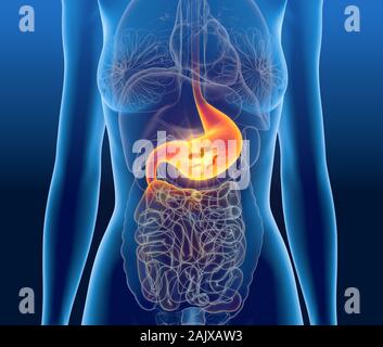 3D-Abbildung mit Escherichia Coli (E. coli) bei schmerzhaften Magen, medizinisch Konzept, Gastritis Stockfoto