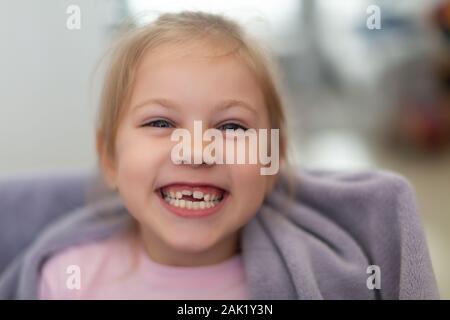 Freundlich lächelnde niedliche Kind mit den Zähnen heraus fallengelassen Vorschüler Mädchen mit offenen Mund ohne Milch Zahn Stockfoto