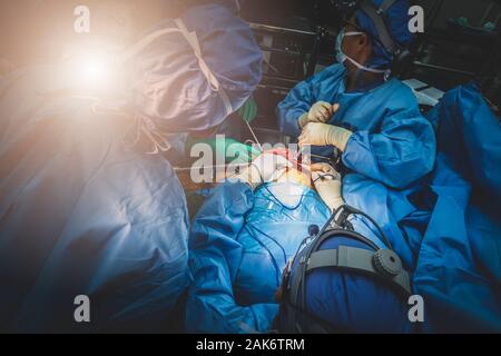 Close up Gruppe von Chirurgen in der Chirurgie Operationssaal. Medizinische team von Chirurgen Chirurgie im Krankenhaus in Betrieb. Stockfoto