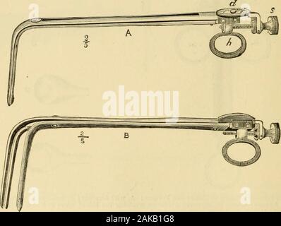 Ein Handbuch von Erkrankungen des Rachens und der Nase: einschließlich der Rachen, Kehlkopf, die Luftröhre, die Speiseröhre, der Nase und dem Rachen. Abb. 49.- Die Autoren Guarded-Wheel Ecraseur. ecraseur. Ich habe dieses Instrument der bewacht - Rad ecraseur. Zwei Fälle, in denen Sie tätig waren wurden von mir gebracht, bevorder Pathologischen Gesellschaft vor einigen Jahren. Dilatatoren DES KEHLKOPFES. Für Dilatation der Kehlkopf, wenn Sie durch organizedmembrane oder durch narbige Gewebe blockiert hat, verschiedene Dilatatoren erfunden worden. In den meisten Fällen ist der Einsatz dieser Instrumente durch die vorherigen erleichtert wird. Abb. 50.- Die Autoren Dil Stockfoto