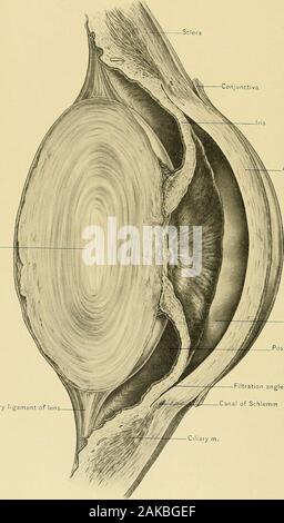 Chirurgische Anatomie: Eine Abhandlung über die menschliche Anatomie in seiner Anwendung auf die Praxis der Medizin und Chirurgie. ituated in der Anterioren und pos-terior Kammern des Auges. Es ist in der hinteren Kammer von theplexus der Schiffe des Ziliarkörpers abgesondert, und zum Teil aus den Behältern in der posteriorsurface der Iris. Die ac [ueous Humor geht von der posterioren chamberthrough die Pupille in die Vorderkammer des Auges, und entkommt durch thespaces von Fontana, den Kanal von Schlemm, und den vorderen ciliarj - Venen. Der posterioren Lymphe Passagen des Auges gehören die hyaloid Canal, der Pe Stockfoto