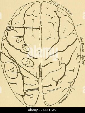 Handbuch der Wahnsinn für Praktiker und Studenten. Abb. 4. Rede und Schreiben (die in einer Gehirnhälfte allein entwickelt) sind nicht in unserem Centro enthaltenen - Motor der Region, der merelyschematic Wert der Division erweist; trotzdem diese beiden wichtigen KORTIKALEN ZENTREN. 11 Zentren befinden sich in unmittelbarer Nähe zu dieser Region. Für Zwecke ofteaching wir eine scharfe Trennung der Zentren, die inreality oft in einen anderen Pass benötigen. Die Rede - Region, insbesondere muss als Composite kortikalen Region angesehen werden. Nur den eckender Rede-Region durch ihre Zentren gebildet werden, während die Corti - cal Stockfoto