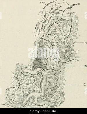 Eine Abhandlung über die hellen Krankheit und Diabetes, mit besonderer Bezugnahme auf die Pathologie und therapeuticsIncluding einen Abschnitt über Retinitis in der hellen Krankheit. mifications des sympathischen im Allgemeinen in Mammalia.* Ich habe mich, nach Dr. Beales Methoden, demonstratedthese Zellen in Verbindung mit Nervenfasern in der schweine Niere t. Dr. Beale sagt weiter, dass diese Kerne, so zahlreich auf den Nerven der Niere, sowie alle peripheren Nerven - Fasern aus verschiedenen Geweben von Mammalia, hithertoincluded haben unter den Bindegewebe Blutkörperchen der Matrix gewesen. Er ist der Auffassung, dass die Nerv-fib Stockfoto