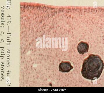 Allgemeine und zahnmedizinischen Pathologie mit besonderer Berücksichtigung der Ätiologie und der pathologischen Anatomie; eine Abhandlung für Studenten und Praktiker. ? Ein *.,.. ft, t. J.-"... Stockfoto