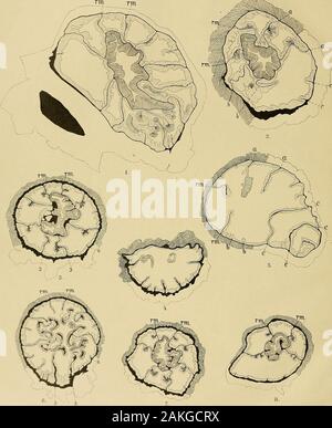 Svenska vetenskapsakademien handlingar. Mesenterien. "4. und 6. Der quersebnitte Lacerationsstiickcben, sterben den Rand der Fussscheibe gamen und des Pro. xl-malsten Ganzs der Körperwand umfassen. "4. (Nr. 30, 22 Tage alt; s. 25.) Reparierenzone (z. T. vielleicbt Neubildungszone) nacb dem Zentrumdes Stiickchens gcrichtet. 6 Schhmdröhre entstanden, von denen zwei in Verbindung mit dem einenRichtungsmeseuterieupaar. "6. (Nr. 40 Bj, 21 Tage alt; s. 26.) Nacb zwei Scbnitten Kombiniert. Der vom Anfang geschlossene Ring (wie in Abb. 4) Ein einer Stelle allmählich und verdiinnt schliesslicb unterbrochen Stockfoto