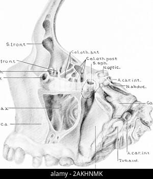 Entwicklung und Anatomie des nasalen Zubehör Nebenhöhlen im Menschen; die Beobachtungen auf zwei Hundert und neunzig seitliche Nasenwände basiert, zeigt die verschiedenen Stufen und Arten der Entwicklung der Zubehör sinus Bereiche aus dem 60. Tag des fötalen Lebens zu fortgeschrittenen Reife. Für rotuaclur Abb. 54. - Muster 22 Jahre, sechs Monate und elf DaysOld. (Serie D, Nr. 93.) der seitlichen Teile der frontalen, ethmoidal, Kiefer und sphenoidal areashave entfernt wurden das Ausmaß und die Beziehungen der Kurven zu zeigen. Notethat zwei ostia maxillaria vorhanden sind, sowohl bei der Kommunikation mit dem infundib-ulum eth Stockfoto