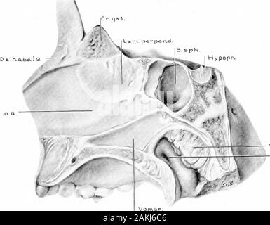 Entwicklung und Anatomie des nasalen Zubehör Nebenhöhlen im Menschen; die Beobachtungen auf zwei Hundert und neunzig seitliche Nasenwände basiert, zeigt die verschiedenen Stufen und Arten der Entwicklung der Zubehör sinus Bereiche aus dem 60. Tag des fötalen Lebens zu fortgeschrittenen Reife. teral Teile des theFrontal, Ethmoidal und maxillaris Bereiche entfernt wurden. (Serie D, Nr. 53.) Die knöchernen Grate auf der medialen Wand des Sinus Maxillaris sind unusuallyprominent. Die größte überlagert den Ductus nasolacrimalis. Es weretwo lacrimal Sac vorhanden, die superior Teil des Kanals wird Bifidum. Notepresenc Stockfoto