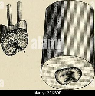 Eine praktische Abhandlung über mechanische Zahnheilkunde. Stockfoto