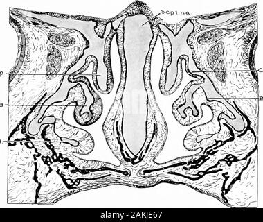 Entwicklung und Anatomie des nasalen Zubehör Nebenhöhlen im Menschen; die Beobachtungen auf zwei Hundert und neunzig seitliche Nasenwände basiert, zeigt die verschiedenen Stufen und Arten der Entwicklung der Zubehör sinus Bereiche aus dem 60. Tag des fötalen Lebens zu fortgeschrittenen Reife. Eit suchspecimens sind so selten von anderen Beobachtern der embryo-Logik und fetalen Bedingungen gefunden, scheint es wahrscheinlicher, dass Dienummer in jedem gegebenen Fall gefunden mehr hängt von theextent auf die Differenzierung durchgeführt wurde als uponthe Absicherung von conchse bereits gebildet. Zuckerkandl givesthree ethmoidal conchse wie die typischen Stockfoto