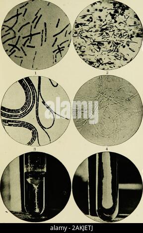 Ein Handbuch der modernen Theorie und Technik der chirurgischen Asepsis. mm Urn. Mikroorganismen. - 1-3, Anthrax Bazillen: 1, Deckel - Glas Zubereitung: 2, von der Milz von amouse; 3, von Kulturen auf einer Petrischale. 4. Anthrax Bazillen mit Sporen, aus einem Gelatine Kultur. 5. Anthrax Kulturen. 6. Kulturen des Typhus Bazillen. Chirurgische ASEPSIS. Platte III. Stockfoto