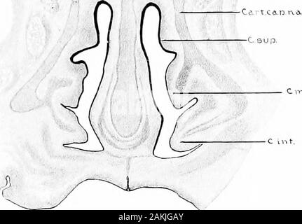 Entwicklung und Anatomie des nasalen Zubehör Nebenhöhlen im Menschen; die Beobachtungen auf zwei Hundert und neunzig seitliche Nasenwände basiert, zeigt die verschiedenen Stufen und Arten der Entwicklung der Zubehör sinus Bereiche aus dem 60. Tag des fötalen Lebens erweiterte Laufzeit. Der Mesoderm in seinem zentralen Teil, followedby Umwandlung in Knorpel (Abb. 9). Die agger nasiwith der Processus uncinatus zusammen die ErsteHauptmuschel von Killian bilden. Allerdings, in dieser Arbeit, es nicht als eine der conchse aufgeführt, zum, obwohl comparativeanatomy zeigt diese Strukturen, die homolog zu der thei werden Stockfoto