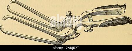 Die Wissenschaft und die kunst der Chirurgie: Eine Abhandlung über die chirurgischen Verletzungen, Krankheiten und Operationen. 858.-verzweigte Speculum. Tig. 857.- CylindricalSpeculum. Stockfoto