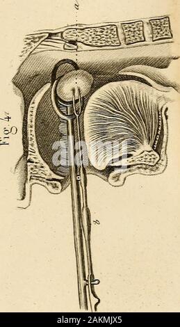 Nun opératoire iconographique de médecine et d'anatomie chirurgicale.bO. Stockfoto