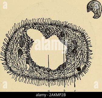 Grundsätze und Praxis der Operative Zahnheilkunde. Progressive eiterung des Zellstoffs. (AfterBlack.) X 100. Ein, gesundes Gewebe; - 6, Blastic odonto-Layer; c, entzündete Gewebe mit di- Adern; d, Linie der Abgrenzung von suppu-Rative; e, pus. Entzündung der ZAHNMARK. 467 nective-Gewebe Zellen in tlie betroffenen Bereich beteiligten produziert ein wie Ergebnis inthem, und durch die Tätigkeit der das Zusammenspiel von Bakterien, die accessthrough externe Kanäle gewonnen haben, oder durch die Avenue der Zirkulation, theexudates und die Gewebe in pus umgewandelt werden. Diese Abszesse sind Usu-Ally liegt Nea Stockfoto