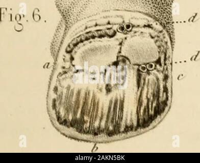 Nun opératoire iconographique de médecine et d'anatomie chirurgicale. Stockfoto