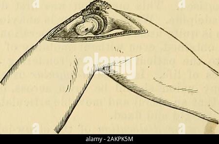 Die Wissenschaft und die kunst der Chirurgie: Eine Abhandlung über die chirurgischen Verletzungen, Krankheiten und Operationen. Abb. 440.- Exzision des Ellbogens: ICH --förmige Schnitt.. Stockfoto