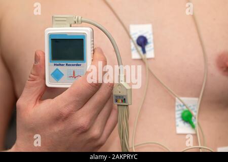 Junger Mann mit Herzerkrankungen, der ein holter-monitorgerät für ein Elektrokardiogramm trägt Stockfoto