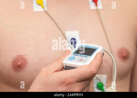 Junger Mann mit Herzerkrankungen, der ein holter-monitorgerät für ein Elektrokardiogramm trägt Stockfoto