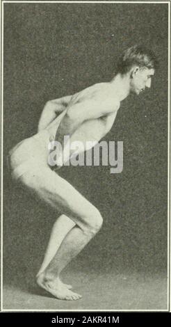 Angewandte Anatomie und Kinesiologie; der Mechanismus der Muskelbewegung. die Beugung der Hüfte bei 45 Grad, aber observationshos^, dass dieser Muskel im Leerlauf ist. Die vasti Muskeln sind jedoch instrong Kontraktion; das Ausmaß, in dem Sie verlängern wird theextent der Beugung des Knies zu; die erforderliche Position der thetrunk zu geben die Kniesehnen zu verkürzen und die rectus verlängern slightlyas die Knie flex. Da es sich nicht um eine geerbte Koordinierung ist, wie ausgeführt, ist es durch freiwillige Arbeit und Praxis erlernt werden. Ich 184 BEWEGUNGEN DES kniegelenk jetzt stellt sich natürlich die Frage, ob die Stockfoto